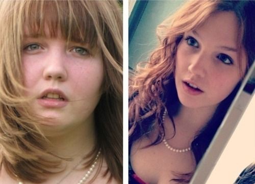 before-after-diet-female (5)