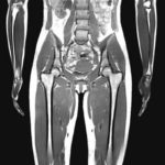 MRI写真で見ると衝撃!女性のダイエット・ビフォーアフター