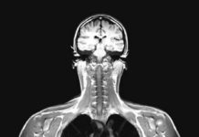 MRI写真で見ると衝撃!女性のダイエット・ビフォーアフター