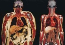 痩せる順番・どこから痩せていくの?