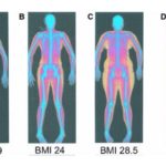 ぽっこりお腹のメカニズムと解消方法