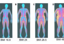 部分やせをビフォーアフター写真で徹底検証!